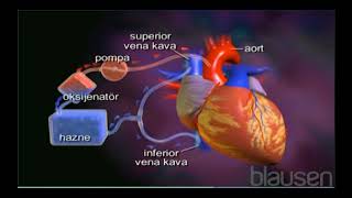 KALP aKCİĞER pOMPASI [upl. by Hudnut842]