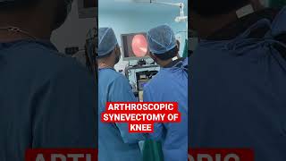 Arthroscopic synovectomy surgery of knee for Synovitis of knee in Jaipur [upl. by Largent]