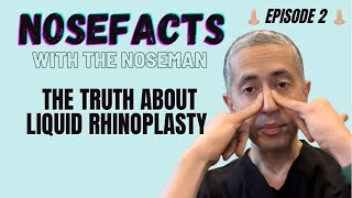 Liquid Rhinoplasty 101 [upl. by Erait]