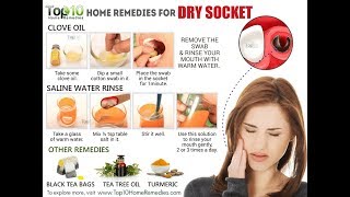 Dry Socket 6 Effective Home Remedies For Dry Socket 6 Natural Cures For Dry Socket [upl. by Enirrok481]