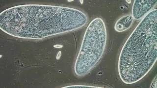 Paramecia Contractile Vacuoles by Edwin Lee [upl. by Kira]