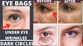 🛑 FACE YOGA FOR EYE BAGS  GET RID OF DARK CIRCLES PUFFY EYES EYE WRINKLES  LIFT DROOPY EYELIDS [upl. by Sandon]