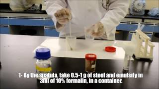 Microscopic examinations of stool sample [upl. by Hellene]