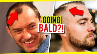 How To Tell If Your Hairline Is Receding  Signs of Balding In Men [upl. by Joeann]