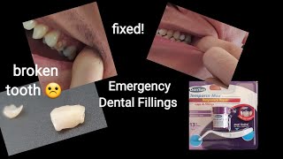 Dentemp  How to replace a tooth filling [upl. by Ancier689]