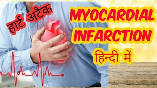 Myocardial infarction in hindi Part 2 [upl. by Aluap]