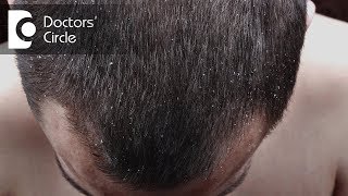 Does fallen dandruff affect skin  Dr Rashmi Ravindra [upl. by Monah786]