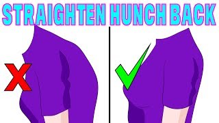 The 4 minute solution to correct hunchback kyphosis [upl. by Yenhoj]