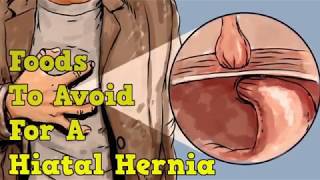 Foods To Avoid For A Hiatal Hernia [upl. by Charbonnier529]