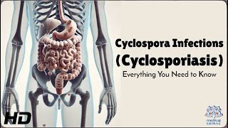 Cyclospora Infection The Parasite You Didn’t Know About [upl. by Lempres]