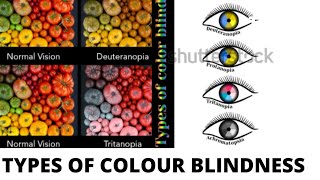 TYPES OF COLOUR BLINDNESS  PROTANOPIA TRITANOPIA DEUTERANOPIA [upl. by Yorgen637]