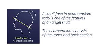 small face to neurocranium ratio [upl. by Eimilb]