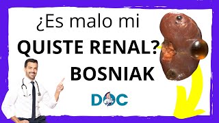 Quiste Renal Complejos Clasificación de Bosniak ¿Pueden dar cáncer los quistes renales [upl. by Annoif]