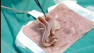 Endoscopia quotLa Historia no Contadaquot parte 6 67 [upl. by Roger413]