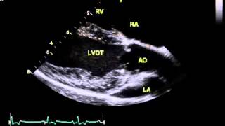 Normal canine echo  right parasternal long axis LVOT view [upl. by Aglo]