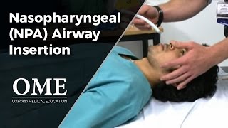 Nasopharyngeal Airway NPA Insertion [upl. by Ydal]