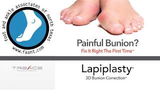 Lapiplasty® 3D Bunion Correction Webinar with FAANT [upl. by Nileek]