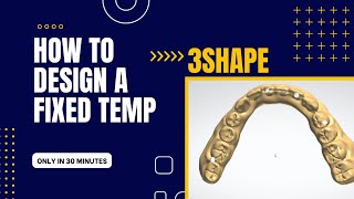 3Shape Temp Fixed BridgeDenture [upl. by Palgrave]