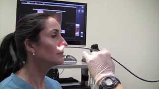 Esophagoscopy Without Sedation TransNasal Esophagoscopy Esophagus Exam Endoscopy [upl. by Hofstetter433]