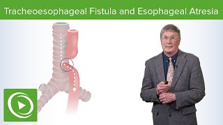 Tracheoesophageal Fistula and Esophageal Atresia  Lecturio Medical [upl. by Aihseyt]