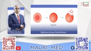 Hématologie  Sphérocytose héréditaire [upl. by Alpers]