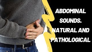 Abdominal Sounds Natural And Pathological [upl. by Abrahams829]