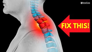 How to Fix a Neck Hump at Home [upl. by Nixon]