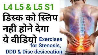 exercises for back pain Disc Dessication stenosis l4l5 l5s1 facet joint by dr sandeep Bhardwaj [upl. by Lamej]