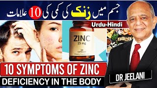 10 Symptoms of Zinc Deficiency in The Body II जिंक की कमी I جسم میں زنک کی کمی کی 10علامات drjeelani [upl. by Ancel]