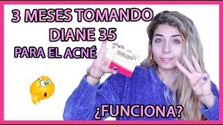 DIANE 35 para el ACNÉ 👉 3 meses ¿Cuando hace efecto [upl. by Atirac]