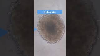 Spheroid analysis with image j spheroid imagej analysis cell shorts short [upl. by Nertie]