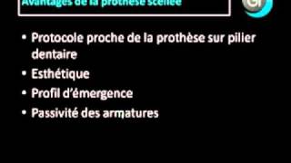 Implant dentaire  Quand réaliser de la prothèse scellée [upl. by Novia111]