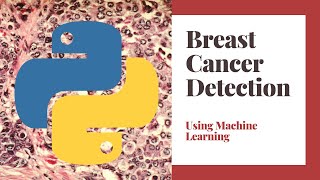 مشويل الشهري  Breast Cancer Detection Machine Learning مشروع الكشف عن سرطان الثدي باستخدام بايثون [upl. by Anirol]