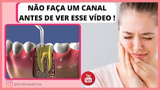 Como é feito um tratamento de canal no dente Dentista [upl. by Aklim]