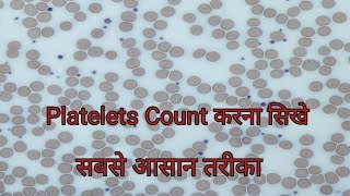 Platelet count under microscope  Platelets Count करना सिखे [upl. by Anohs]