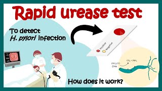 UREA BREATH TEST for Helicobacter Pylori Explained [upl. by Mohorva]