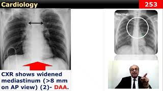 internalmedicine cme usmle محاضراتباطنة ecg كورساتباطنة clinical clinical medicine [upl. by Clem]