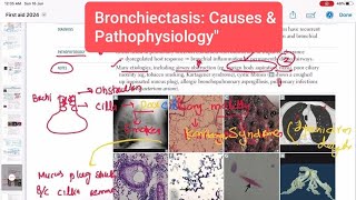 Bronchiectasis Causes amp Pathology Respiratory 38  First Aid USMLE Step 1 in UrduHindi [upl. by Eustis]