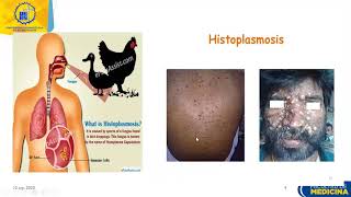 Microbiología para medicina Micosis profundas Histoplasmosis y criptococosis [upl. by Anaitit]