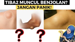 MUNCUL BENJOLAN ANEH DI TUBUH Kupas Tuntas Penyakit Lipoma [upl. by Ahsieyk]