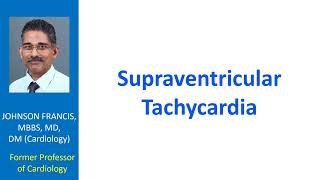 Supraventricular Tachycardia [upl. by Airemaj263]