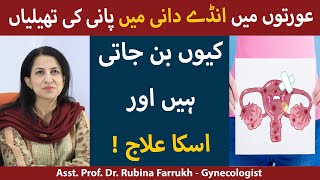 Anda Dani Ki Rasoli Ka Ilaj  Ovarian Cyst Signs And Symptoms In Urdu  Ovarian Cyst Kaise Thik Kare [upl. by Akihsay]