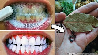 Secret that Dentists dont want you to know Remove Tartar and Teeth Whitening in just 2 minutes [upl. by Rhynd835]