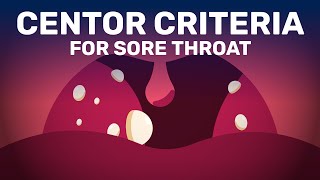 Is Your Sore Throat Caused by Bacterial Infection or Viral [upl. by Lemaceon780]