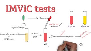 IMViC Tests  Procedure and Principle  Microbiology [upl. by Siahc]