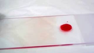 Geste technique  frottis sanguin  Blood smear [upl. by Enautna]