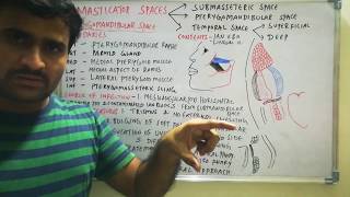 Pterygomandibular space infection [upl. by Nedlog]