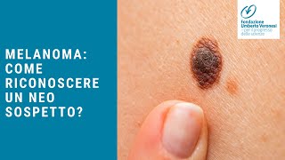 Melanoma come riconoscere un neo sospetto Le regole dellesperto [upl. by Lomasi419]