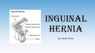 TMT CT Hernia Imaging II Femoral vs Inguinal by Dr Jeshil Shah [upl. by Serene]