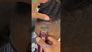 quotUnbelievable Transformations The Craziest Hairline Fixes Everquot [upl. by Enyawad]